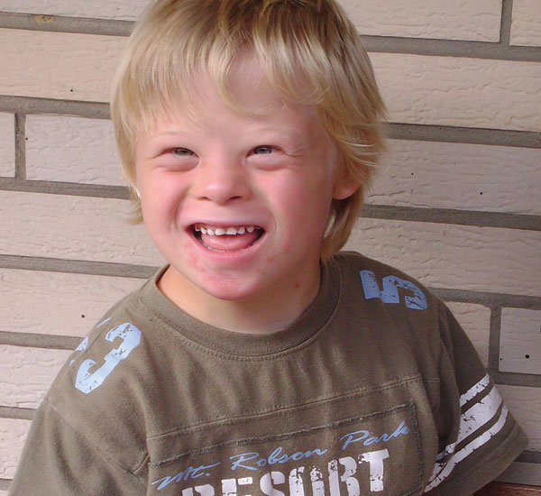 Down-Syndrome-Association