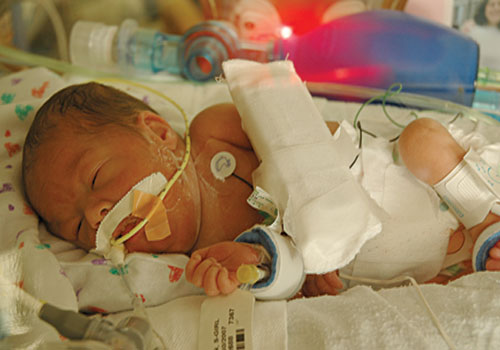 Kailyn, one-month-old, in the NICU. 